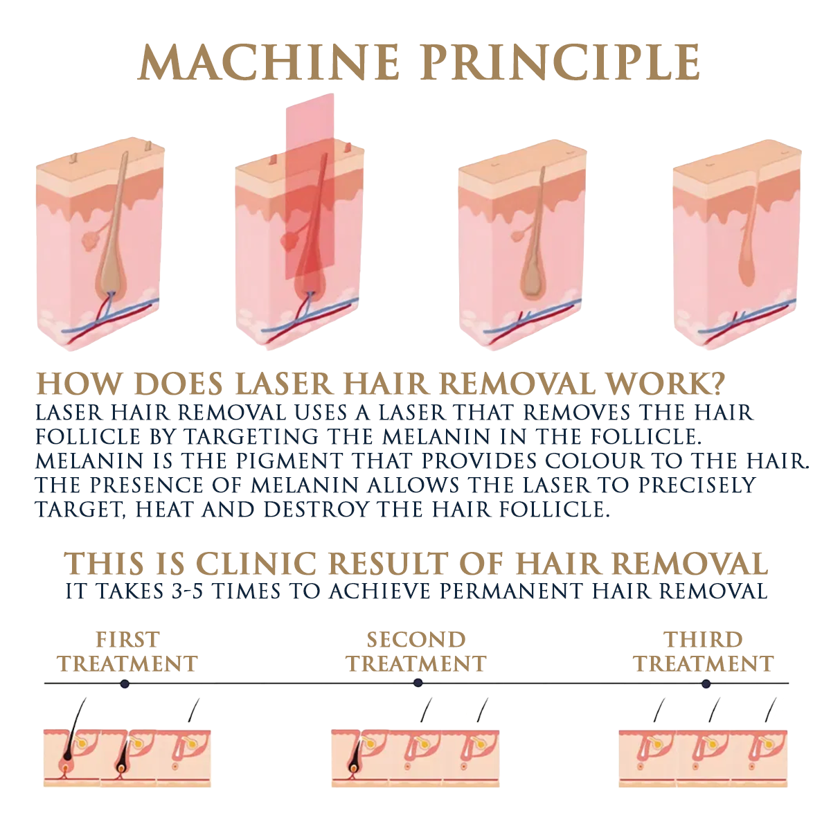 Skin Monarch Qantum Pro Diode & Picosecond Laser